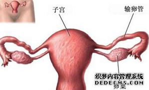 哪些女性容易感染附件炎